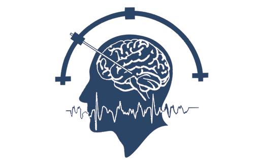 dbs脑深部电刺激疗法,dbs脑深部电刺激手术费用