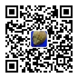 苏泊尔2.5升电水壶,苏泊尔2.0升电热水壶