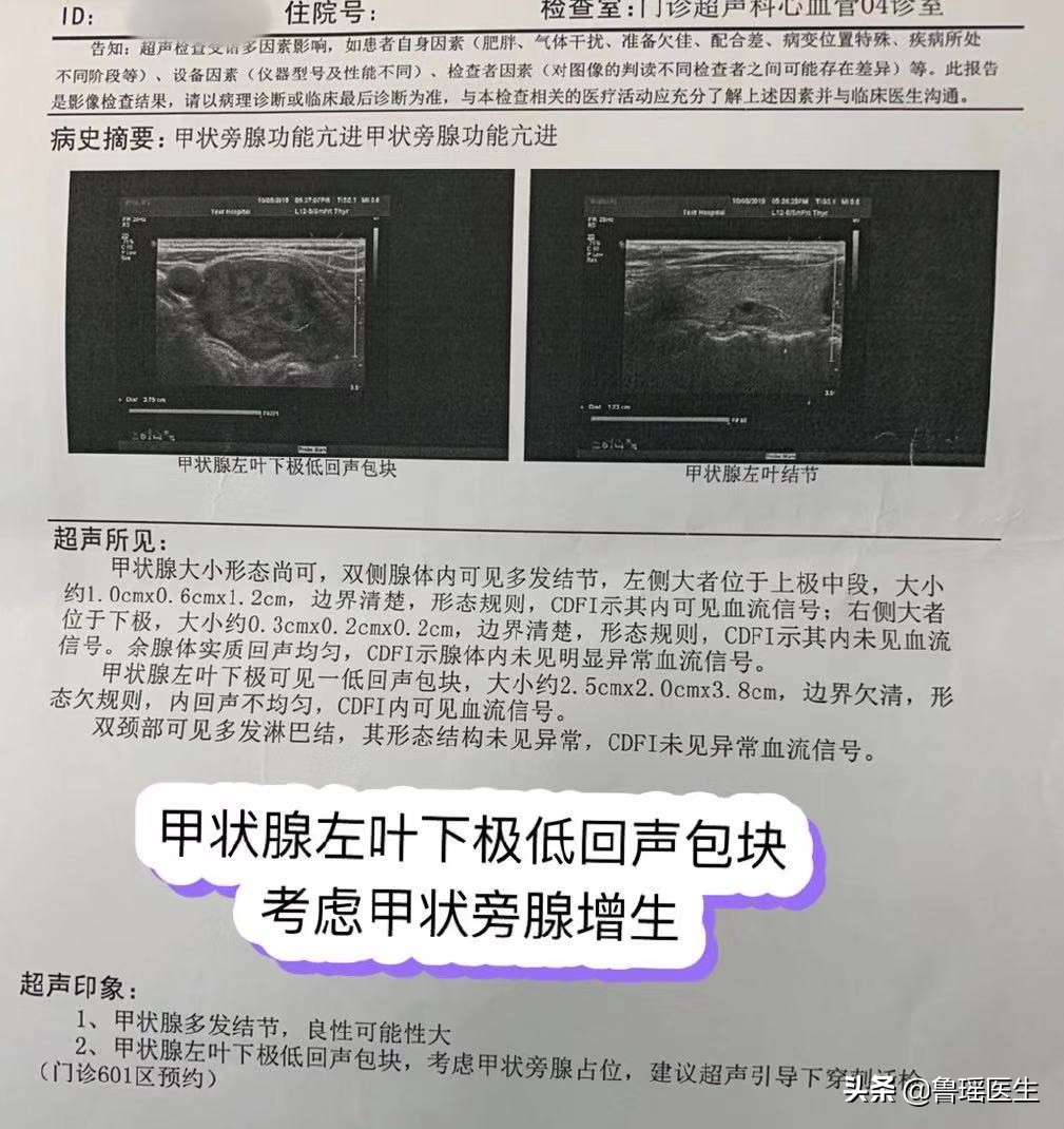 尿道结石会导致腹胀消化不良吗,关节炎和尿路结石是什么代谢异常