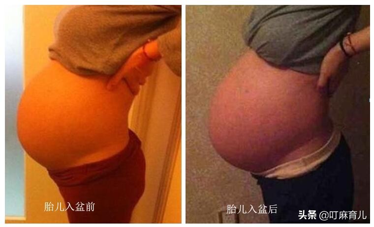 孕晚期胎动突然减少是什么原因,孕晚期肚子发紧发硬疼胎动减少