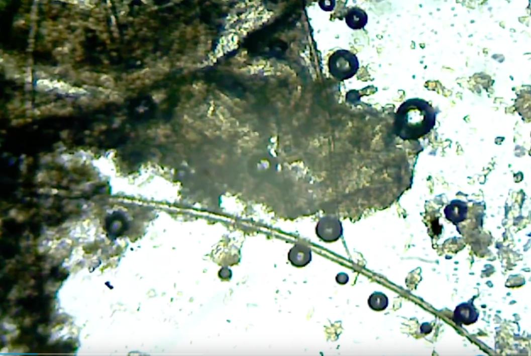 在显微镜下的耳屎有多脏,把耳屎放在显微镜下是什么