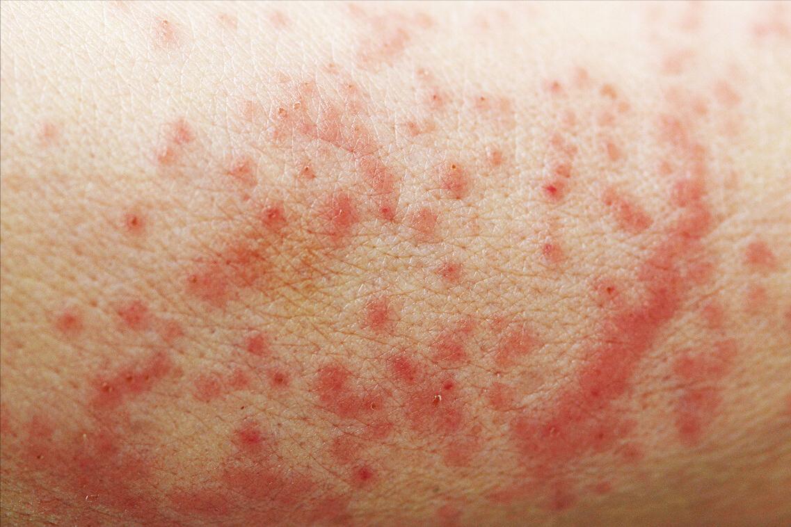 手臂有小红点是什么原因,手臂上出现很多小红点是什么原因