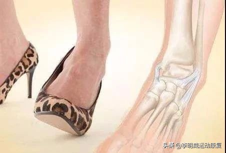 轻度脚踝扭伤的处理方法及康复,脚踝扭伤康复训练6种简单方法