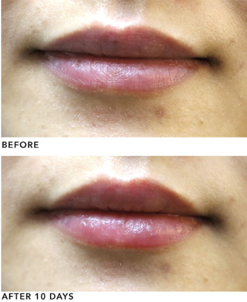 hb年终盛典,奥杰尼胶原蛋白润唇膏