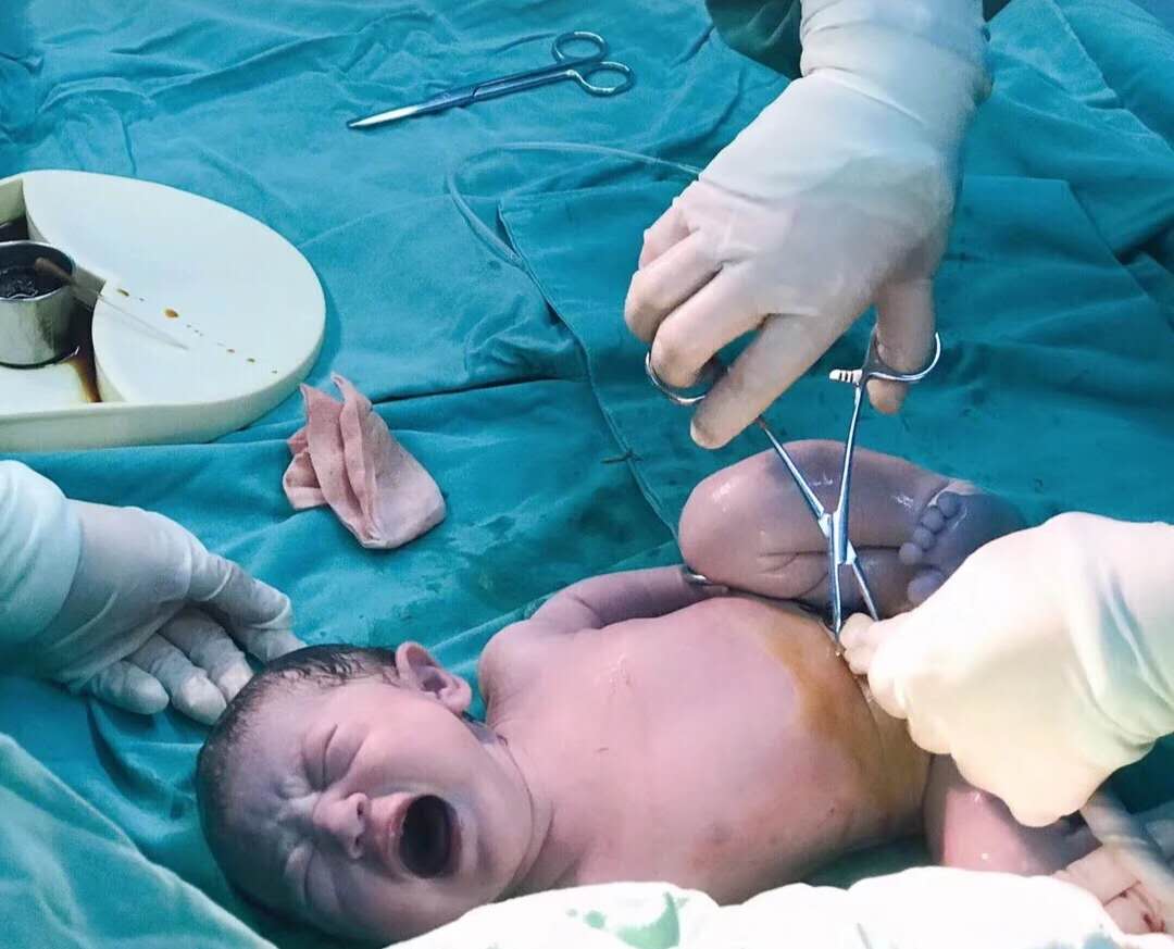 为什么孕妈打喷嚏娃老动,孕中期打喷嚏就漏尿怎么回事