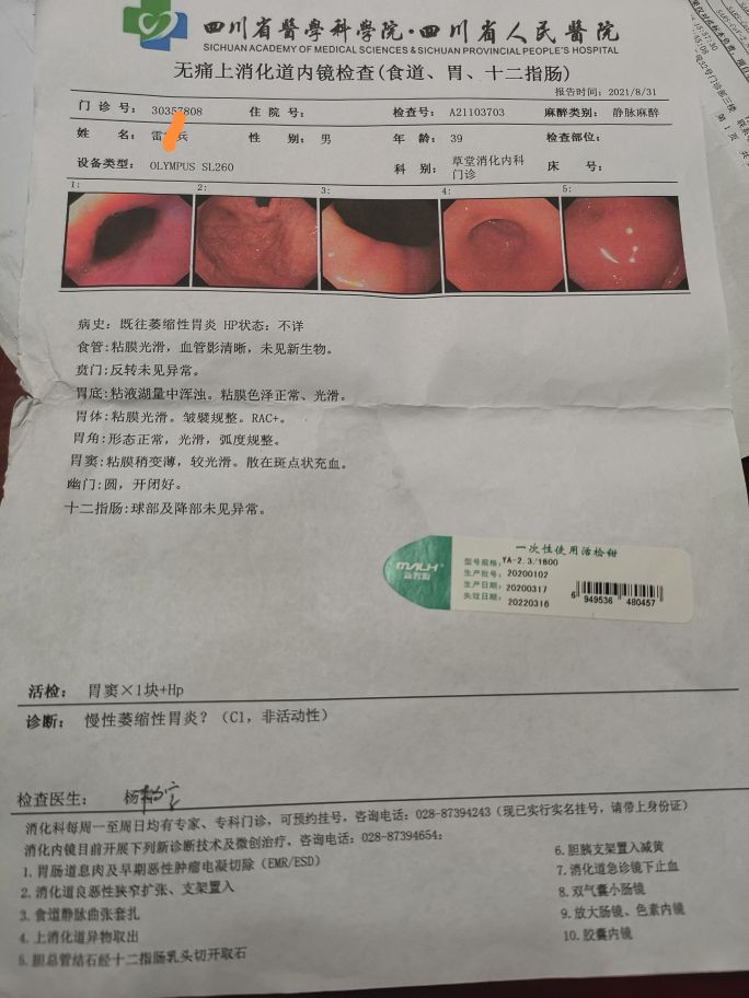 一个逆转的萎缩性胃炎患者自述,萎缩性胃炎被逆转了