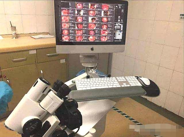 看了体检报告我懵了，这是不是宫颈癌？