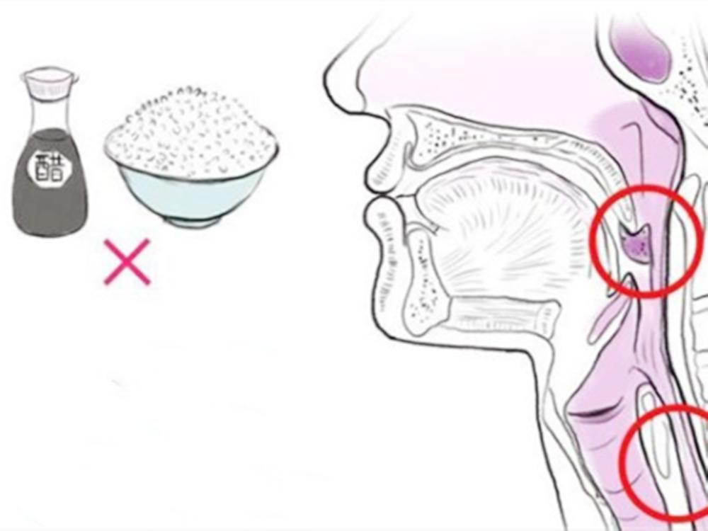 小孩吃鱼被刺卡住了的视频,儿童吃鱼被刺卡住了怎么办