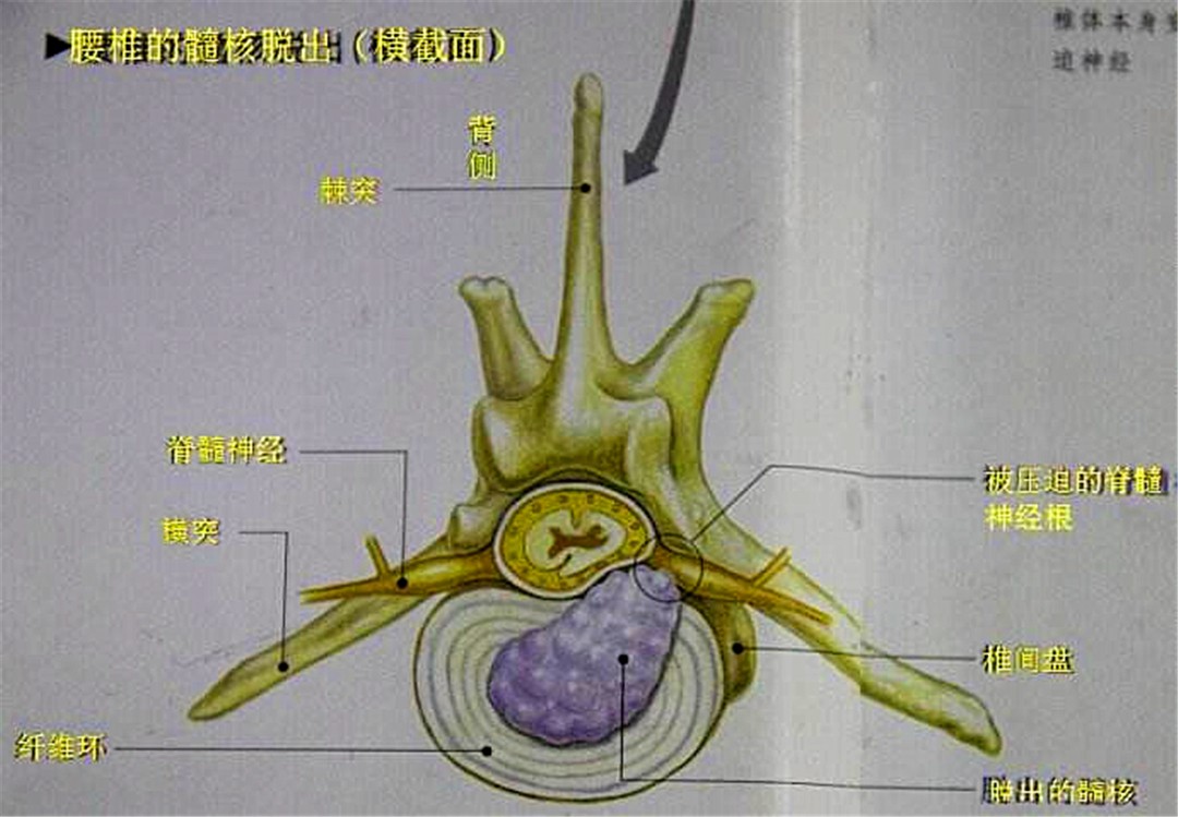 辟谣，狗狗也会腰椎盘突出，不合理运动伤害大，注意三点正确护理