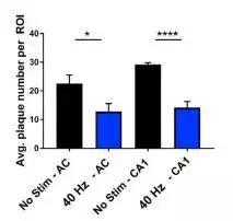 40赫兹预防老年痴呆音乐,新发现有望治疗阿尔茨海默病