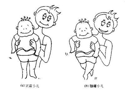 脑瘫智力低下的孩子,脑瘫的孩子智商低怎么办