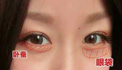 赵丽颖卧蚕眼袋,赵丽颖有眼袋与无眼袋