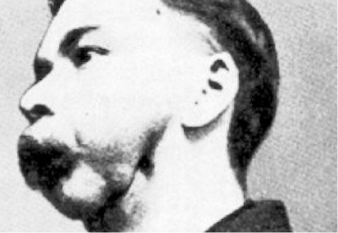 吃一口核废料会怎样?外国富豪把镭当补药,连喝1400瓶含镭药水