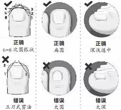 跑步为什么有黑指甲,跑步黑脚趾怎么办