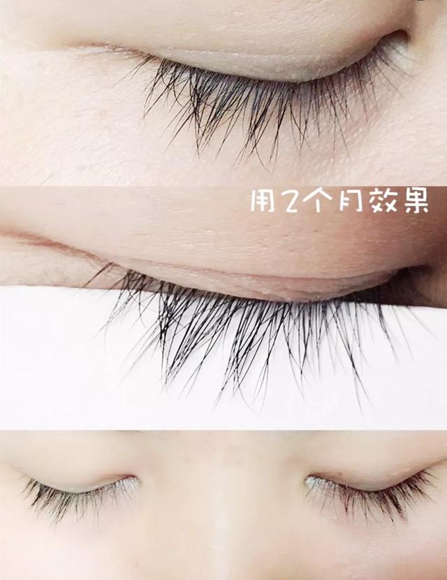 美国版睫毛增长液,法国进口的睫毛增长液真的有效吗