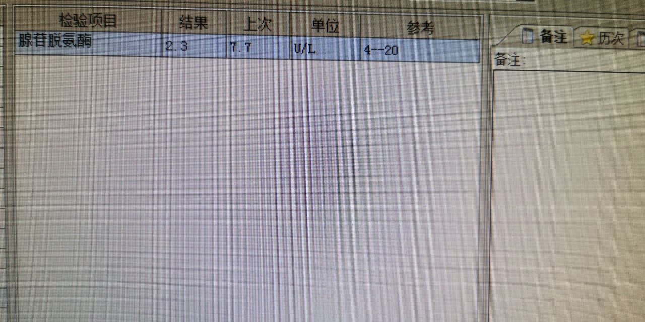 中西医结合治疗原因不明肠梗阻、腹水转氨酶明显升高病案一例！