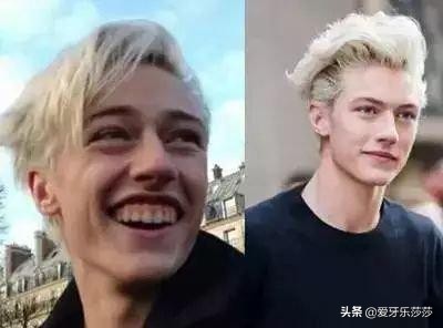 毁灭式的露龈笑也能重获笑容自由,毁灭式