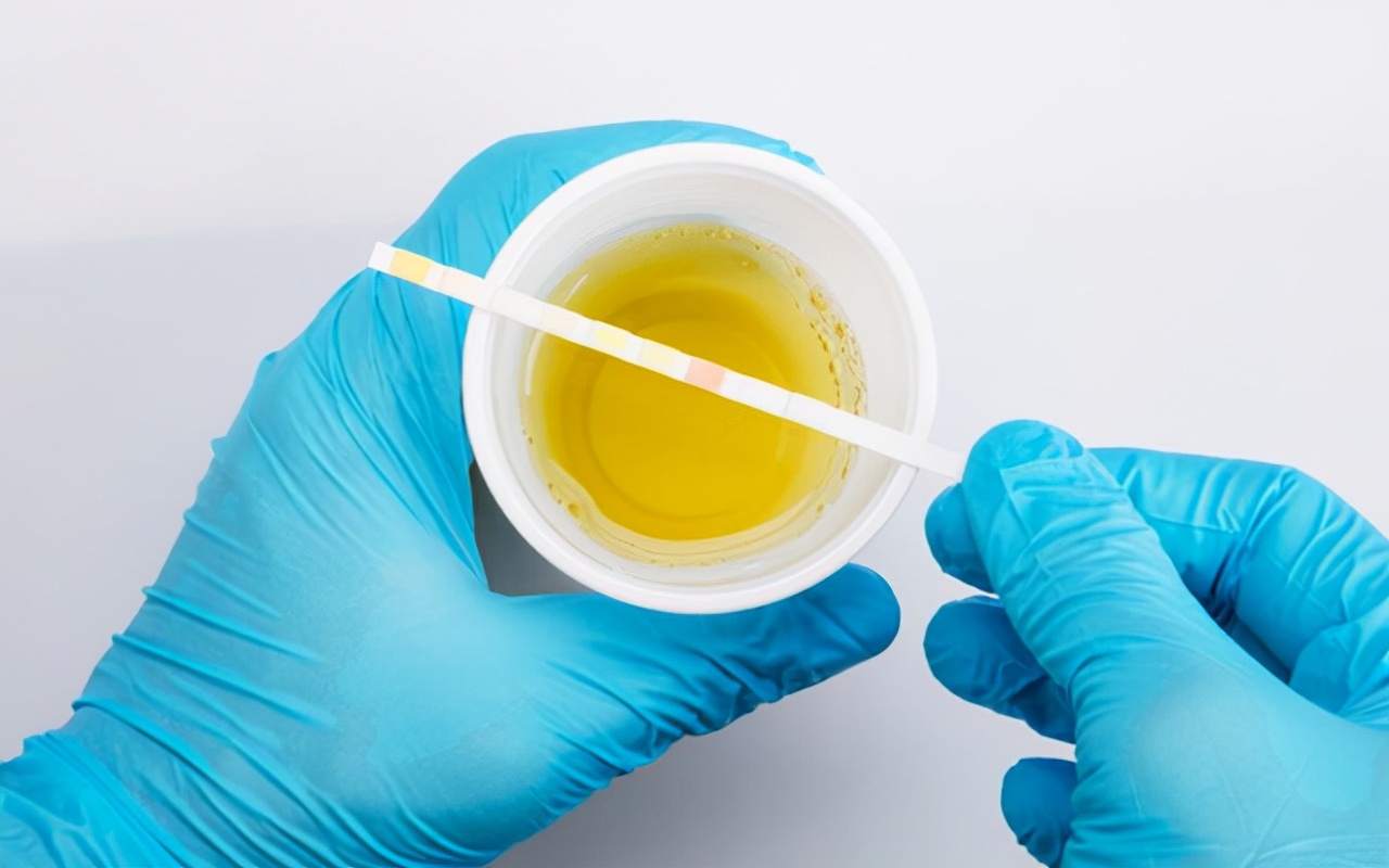 过敏性紫癜红点消退后走路可以吗,过敏性紫癜吃中药期间反复起红点