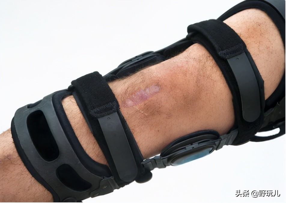 护膝到底有没有用,运动护膝与普通护膝区别