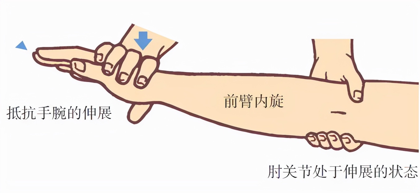 胳膊肘疼痛说是网球炎怎么治疗,网球肘两个胳膊都痛