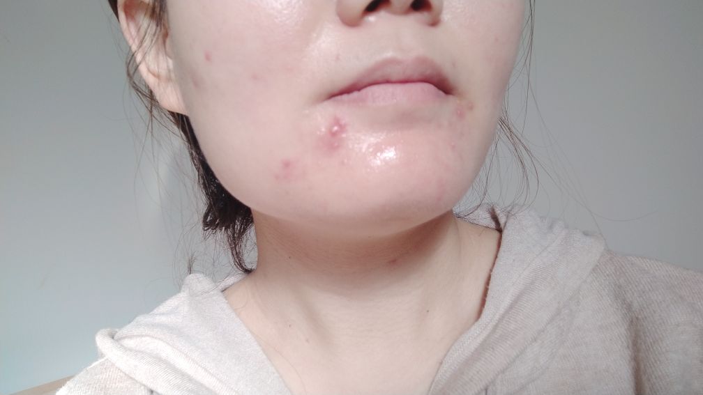 亲身经历的护肤分享,29岁女护肤品