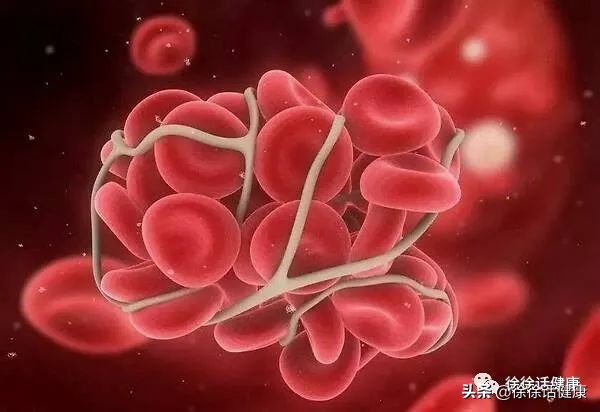 牙疼不是病疼起来要命萌图,牙疼不是病疼起来真要命广告