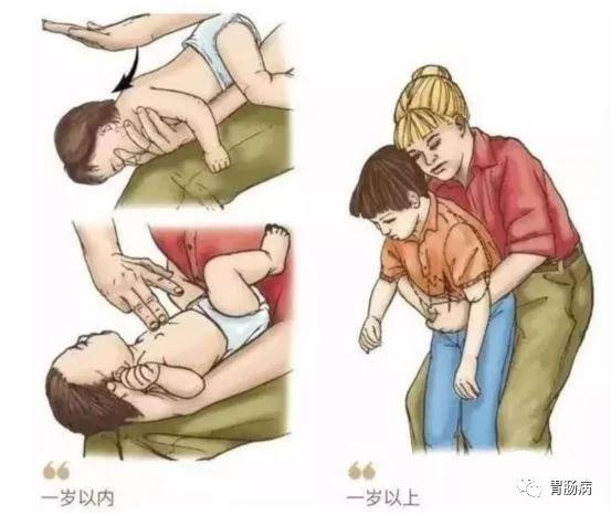 6岁儿童吞了一个纽扣怎么办,2岁宝宝吞了塑料纽扣能排出来么