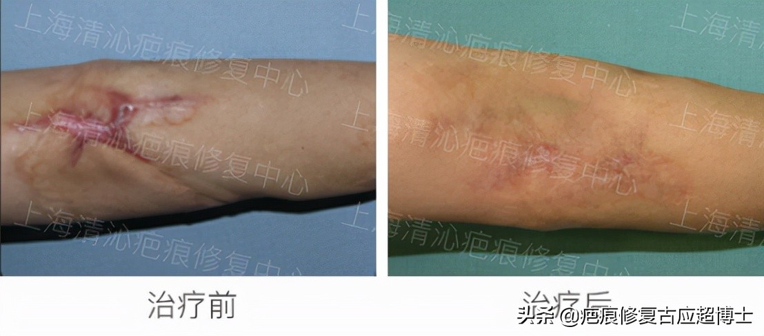 涓嶅繕鍒濆績鐮ョ牶鍓嶈鍖犲績绛戞ⅵ,涓嶅繕鍒濆績鍖犲績绛戞ⅵ