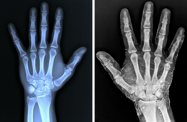 x射线下的人体图,x射线照片