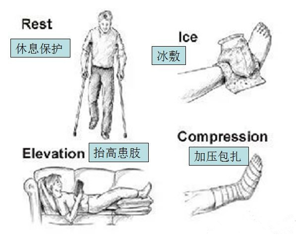 跑步圈常用术语100句,跑者最想了解的跑步基本知识