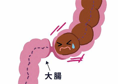 泻药酚酞,酚酞便秘药