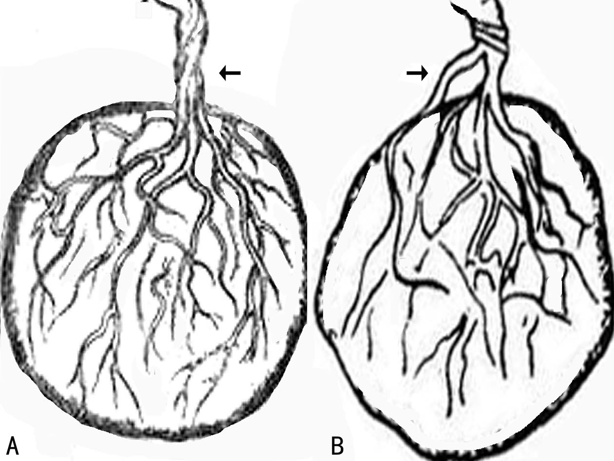 做彩超可以看出来脐带多长吗,超声检查脐带绕颈一圈正常吗