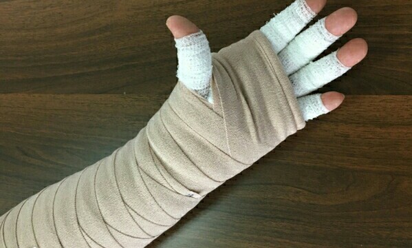 乳腺癌术后患侧上肢肿胀,什么原因呢?