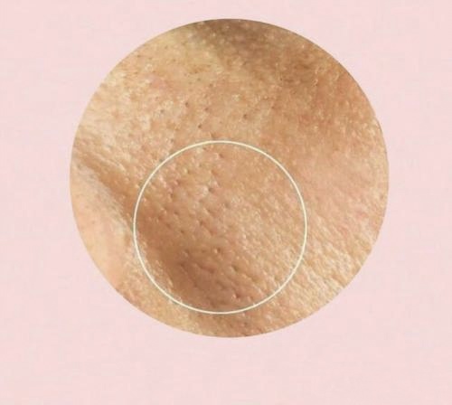 油皮毛孔粗大毛孔多要怎么改善,油皮毛孔粗大护肤品