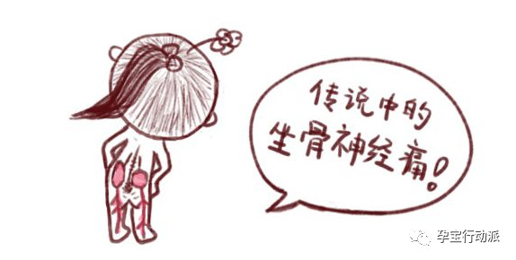 孕期大腿痛跟坐骨神经有关吗,孕期右侧坐骨神经痛哪侧睡觉