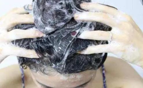 头发上有雪花状头屑用什么洗发水,头屑多的像下雪怎么洗