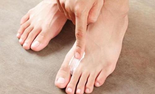 脚气痒痒难忍可以用热水烫吗,脚气痒痒难忍没有药膏