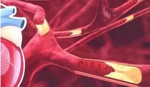 益生菌对身体调理帮助大吗,益生菌真是对肠胃有好处吗