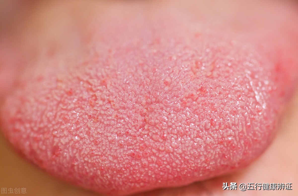 胃火旺舌头疼怎么调理,舌尖疼心火旺刮什么穴位