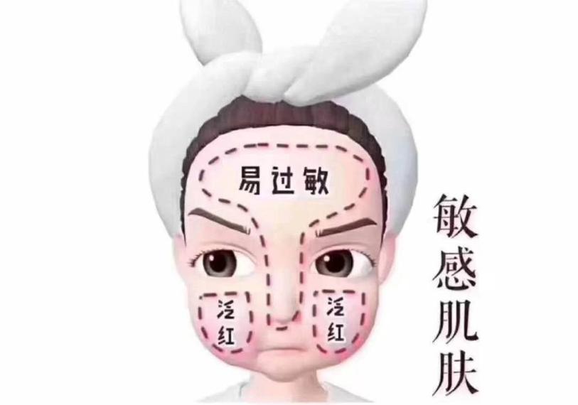 10秒教会你辨别自己的皮肤类型,常见的皮肤分析方法