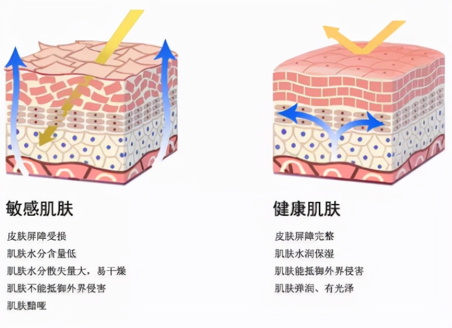 如何根据不同肤质挑选护肤品呢,角质层薄混合肤质用什么护肤品
