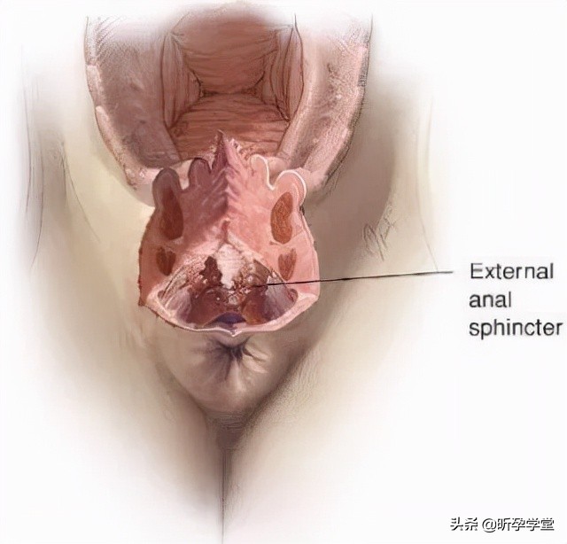 医生不建议侧切,医生不给我缝合伤口