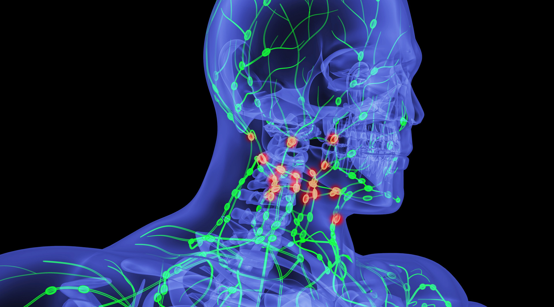 淋巴癌怎么引起的原因,淋巴癌是怎么得的什么原因造成的