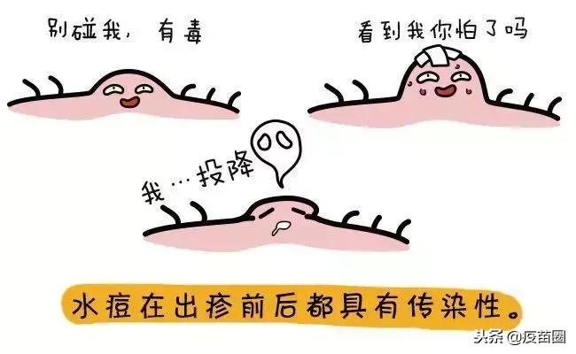 水痘高发期间谨记战痘三大招,水痘高发期战痘防护要做好