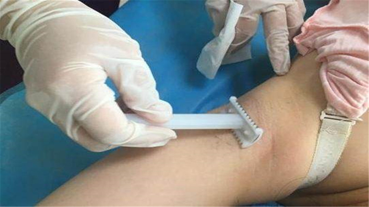 孕妇生孩子前备皮,90后孕妇怀胎7个月被迫剖腹产