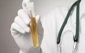 孕妇血压高蛋白尿怎么办,孕妇血压高导致蛋白尿高