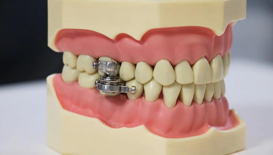 真正有效的减肥神器,减肥的软件管住嘴迈开腿