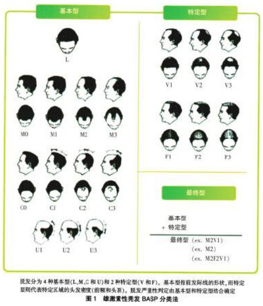 生酮饮食脱发严重怎么办,雄激素性脱发饮食注意什么