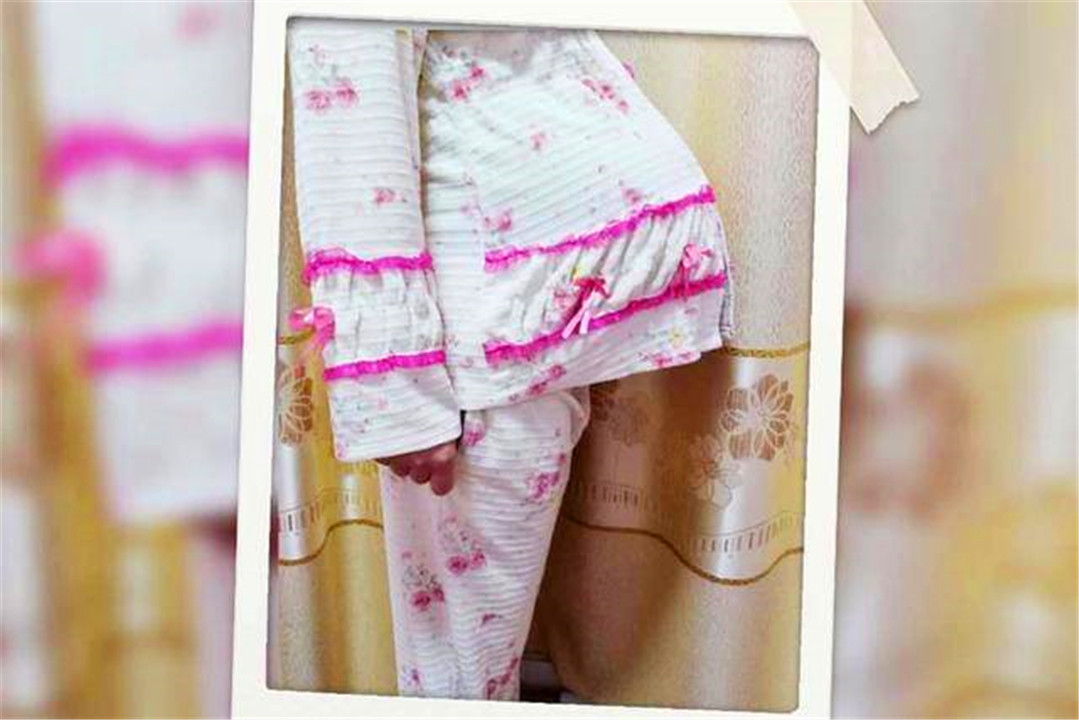 “悬垂肚”有多糟心？十有八九要剖产，还有这些生理尴尬在等待