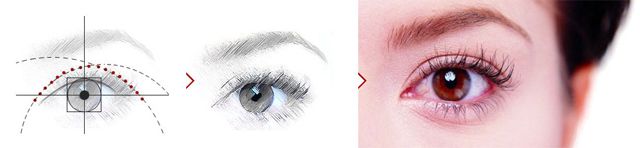 埋线双眼皮术后效果,双眼皮埋线术后消肿日记